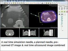Navigating on CT and US fusion